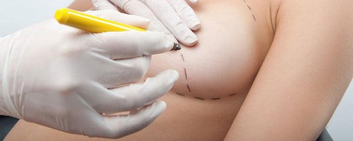 De ce sa alegi silicoane mici