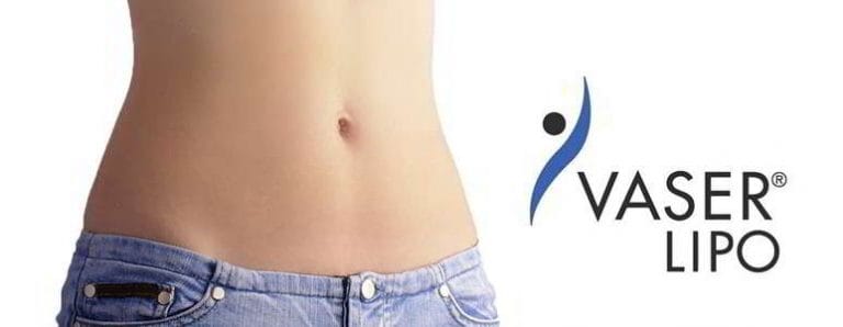 Despre liposuctia vaser
