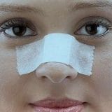 Sfaturi de recuperare dupa rinoplastie