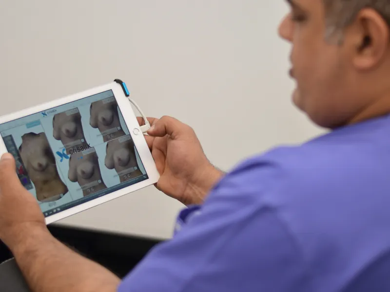Dr. Rachad prezintă pe tabletă rezultatele augmentării mamare cu grăsime proprie